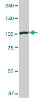 Anti-MSH2 Rabbit Polyclonal Antibody