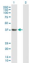 Anti-PDS5A Mouse Polyclonal Antibody