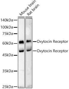 Anti-Oxytocin Receptor Rabbit Polyclonal Antibody