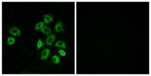 Immunofluorescence analysis of MCF7 cells using Anti-GPRC5B Antibody. The right hand panel represents a negative control, where the antibody was pre-incubated with the immunising peptide