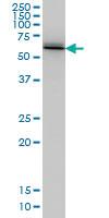 Anti-UBQLN2 Mouse Monoclonal Antibody [clone: 5F5]