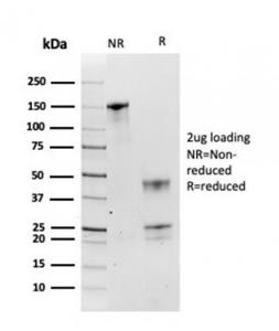 SDS-PAGE analysis of Anti-HSP90 beta Antibody [HSP90AB1/3954] under non-reduced and reduced conditions; showing intact IgG and intact heavy and light chains, respectively. SDS-PAGE analysis confirms the integrity and purity of the antibody.