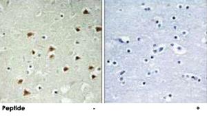 Anti-ABHD14B Rabbit Polyclonal Antibody