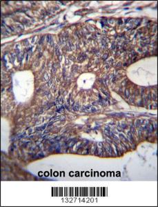 Anti-UQCRB Rabbit Polyclonal Antibody (HRP (Horseradish Peroxidase))