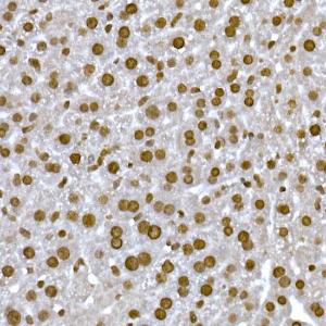 Immunohistochemistry analysis of paraffin-embedded mouse liver using Anti-Histone H1.2 Antibody (A9176) at a dilution of 1:200 (40X lens). Perform high pressure antigen retrieval with 10 mM citrate buffer pH 6.0 before commencing with IHC staining protocol