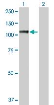 Anti-MSH2 Rabbit Polyclonal Antibody