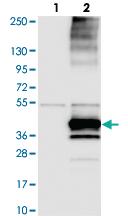 Anti-KCNK17 Rabbit Polyclonal Antibody