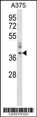 Anti-ORAI1 Rabbit Polyclonal Antibody (AP (Alkaline Phosphatase))