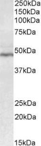 Anti-CD28 antibody