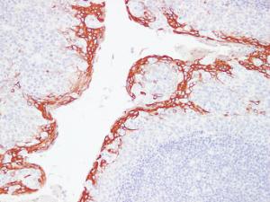 Immunohistochemical analysis of paraffin-embedded human Tonsil using Anti-Cytokeratin 16 Antibody