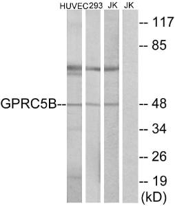 Western blot analysis of lysates from Jurkat, HUVEC, and 293 cells using Anti-GPRC5B Antibody. The right hand lane represents a negative control, where the antibody is blocked by the immunising peptide