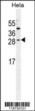 Anti-IGF2 Rabbit Polyclonal Antibody [clone: 125CT13.3.5]