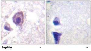 Anti-CD4 Rabbit Polyclonal Antibody