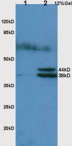 Anti-HP Rabbit Polyclonal Antibody