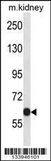 Anti-KCNC2 Rabbit Polyclonal Antibody (FITC (Fluorescein Isothiocyanate))