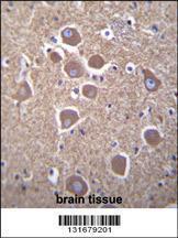 Anti-TUBB2B Rabbit Polyclonal Antibody (FITC (Fluorescein Isothiocyanate))