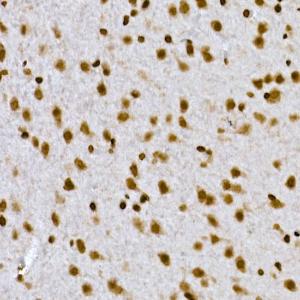 Immunohistochemistry analysis of paraffin-embedded rat brain using Anti-Histone H1.2 Antibody (A9176) at a dilution of 1:200 (40X lens). Perform high pressure antigen retrieval with 10 mM citrate buffer pH 6.0 before commencing with IHC staining protocol