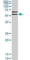 Anti-UBQLN2 Mouse Monoclonal Antibody [clone: 5F5]