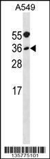 Anti-MYF5 Rabbit Polyclonal Antibody (HRP (Horseradish Peroxidase))