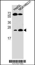 Anti-RHOJ Rabbit Polyclonal Antibody (AP (Alkaline Phosphatase))