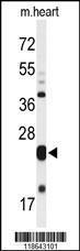 Anti-MLF1 Rabbit Polyclonal Antibody (FITC (Fluorescein Isothiocyanate))