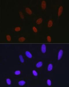 Immunofluorescence analysis of U2OS cells using Anti-Histone H1.2 Antibody (A9176) at a dilution of 1:200 (40X lens). DAPI was used to stain the cell nuclei (blue)