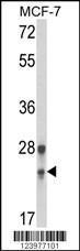 Anti-GINS1 Rabbit Polyclonal Antibody (PE (Phycoerythrin))