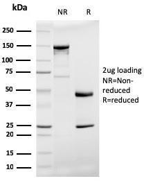 SDS-PAGE analysis of Anti-Prohibitin Antibody [PHB/3194] under non-reduced and reduced conditions; showing intact IgG and intact heavy and light chains, respectively. SDS-PAGE analysis confirms the integrity and purity of the antibody.