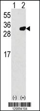 Anti-PRDX6 Rabbit Polyclonal Antibody