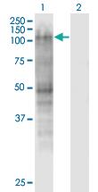 Anti-MSH2 Mouse Monoclonal Antibody [clone: 2G9]