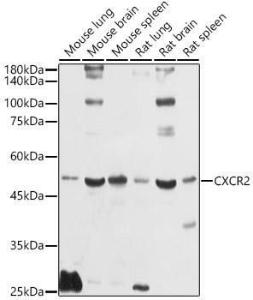 Western blot analysis of extracts of various cell lines, using Anti-CXCR2 Antibody (A9177) at 1:1,000 dilution The secondary antibody was Goat Anti-Rabbit IgG H&L Antibody (HRP) at 1:10,000 dilution Lysates/proteins were present at 25 µg per lane