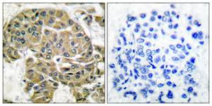 Antibody anti-mammaglobin B 100 µg