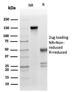 SDS-PAGE analysis of Anti-Fas Ligand Antibody [FASLG/4453] under non-reduced and reduced conditions; showing intact IgG and intact heavy and light chains, respectively. SDS-PAGE analysis confirms the integrity and purity of the antibody.