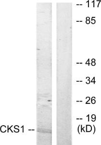 Western blot analysis of lysates from Jurkat cells, treated with serum 20% 15' using Anti-CKS1 Antibody. The right hand lane represents a negative control, where the antibody is blocked by the immunising peptide.