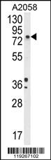 Anti-DBH Rabbit Polyclonal Antibody [clone: 136CT29.7.4]