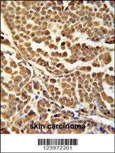 Anti-RNF114 Rabbit Polyclonal Antibody (FITC (Fluorescein Isothiocyanate))