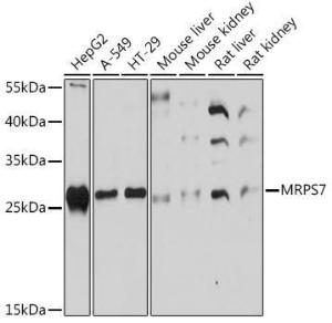 Western blot analysis of extracts of various cell lines, using Anti-MRPS7 Antibody (A93261) at 1:1,000 dilution. The secondary antibody was Goat Anti-Rabbit IgG H&L Antibody (HRP) at 1:10,000 dilution.