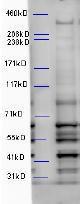 Anti-WDFY3 Antibody (A85210) (5 µg/ml) staining of Mouse Brain lysate (35 µg protein in RIPA buffer). Primary incubation was 1 hour. Detected by chemiluminescence