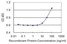 Anti-MSH2 Mouse Monoclonal Antibody [clone: 2G9]