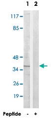 Anti-AWAT1 Rabbit Polyclonal Antibody