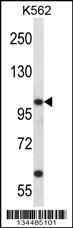 Anti-KCNC3 Rabbit Polyclonal Antibody (AP (Alkaline Phosphatase))