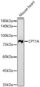 Anti-CPT1A Rabbit Monoclonal Antibody [clone: ARC51171]