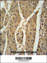 Anti-PRAMEF20 Rabbit Polyclonal Antibody