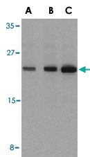 Anti-BAD Rabbit Polyclonal Antibody