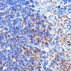 Immunohistochemistry analysis of paraffin-embedded mouse spleen using Anti-CXCR2 Antibody (A9177) at a dilution of 1:100 (40x lens) Perform microwave antigen retrieval with 10 mM PBS buffer pH 72 before commencing with IHC staining protocol