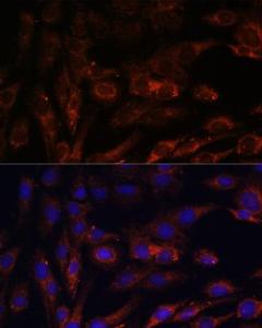 Immunofluorescence analysis of C6 cells using Anti-MRPS7 Antibody (A93261) at a dilution of 1:100. DAPI was used to stain the cell nuclei (blue).