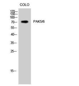 Western blot analysis of COLO cells using Anti-PAK5 + PAK6 Antibody