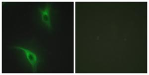 Immunofluorescence analysis of HeLa cells using Anti-CKS1 Antibody. The right hand panel represents a negative control, where the antibody was pre-incubated with the immunising peptide.