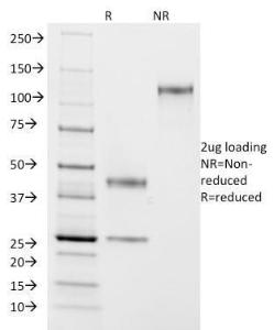 SDS-PAGE analysis of Anti-ASRGL1 Antibody [CRASH/1290] under non-reduced and reduced conditions; showing intact IgG and intact heavy and light chains, respectively. SDS-PAGE analysis confirms the integrity and purity of the antibody.