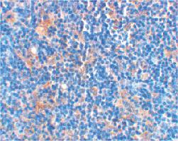 Anti-BAD Rabbit Polyclonal Antibody